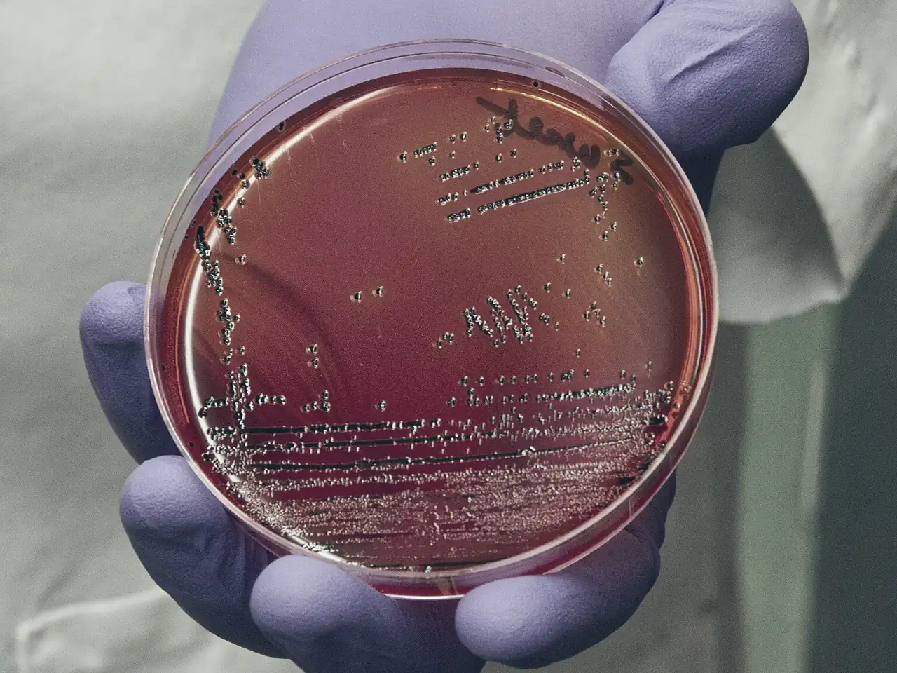 Gloved hand holding a Petri dish with bacterial colonies